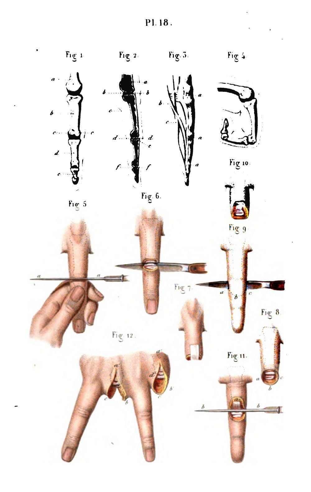 157 Old Books Surgery Medical Survival Surgical Techniques Instruments